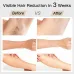 Bosidin IPL Laser System - At Home Laser Hair Removal